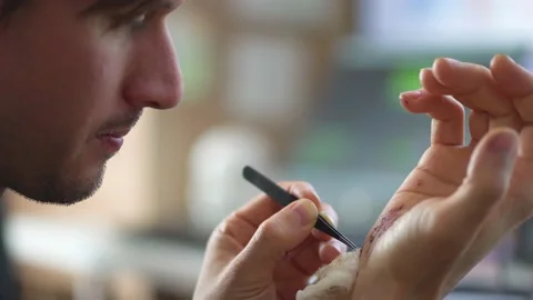 Man cleaning a bleeding wound under the skin after the accident. Treatment and Stock Footage 134541430