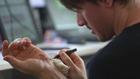 Man cleaning a bleeding wound under the skin after the accident. Treatment and Stock Footage 135123904