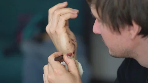 Man cleaning a bleeding wound under the skin after the accident. Treatment and Stock Footage 135274554