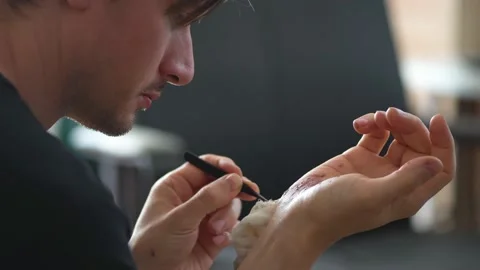 Man cleaning a bleeding wound under the skin after the accident. Treatment and Stock Footage 136308190