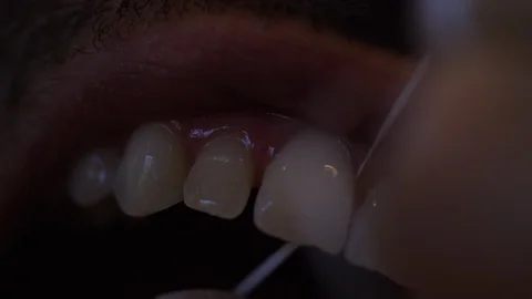 Man cleaning his teeth with thread Stock Footage 100009872