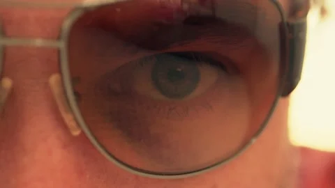 Man conceals bruised eye with sunglasses. Violence or abuse concept Stock Footage 239241740