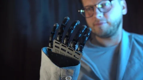 Man Controls Electronic Prosthetic Arm Using Bionics Technology Cyber Hand Video stock 123671555
