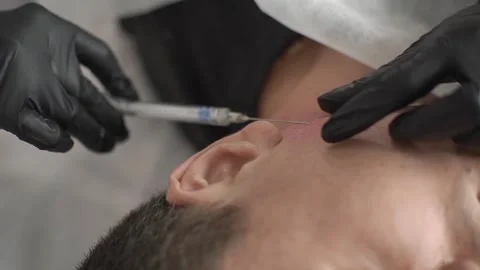 A man at a cosmetologists appointment injects Botox into his face Stock Footage 313695424