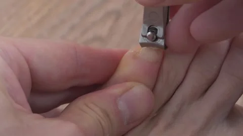 A man cuts his little toe nail using nail clipper. Foot and toes of an adult man Vídeos de archivo 317048798