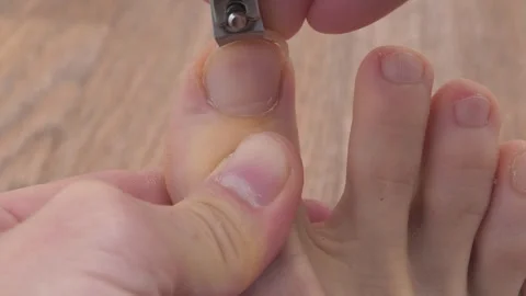 Man cuts his toenail using a nail clipper. Foot and toes of an adult man Stock-Footage 318035614