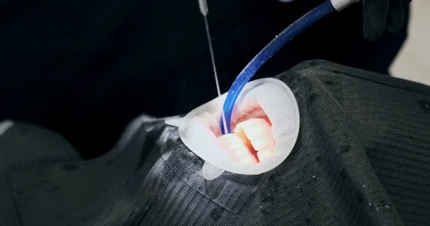 Man dentist's hands close up. Air flow teeth cleaning Stock-Footage 129611283