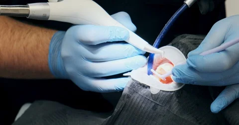 Man dentist's hands close up. Air flow teeth cleaning Stock Footage 129611404