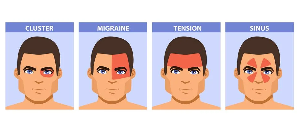 Man with Different Migraine Status Vector Illustration Stock Illustration