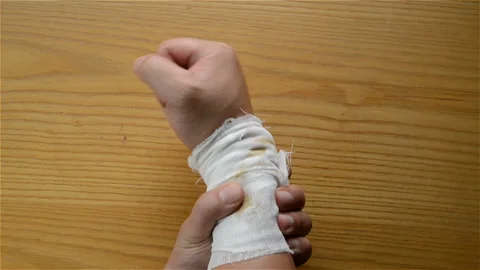 Man doing physiotherapy on his hurted hand Stock Footage 95521901