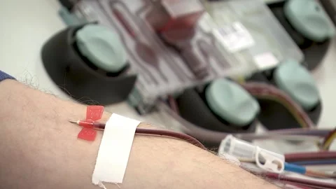 The man donates blood. Close up. Stock Footage 148148651