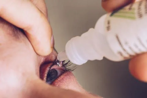 A man drips open human eye with bright red arteries drops to improve vision c Stock Photos