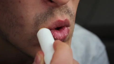 Man with dry lips smears lips with male hygienic lip balm. Stock Footage 142510184