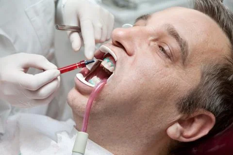 Man during teeth whitening process Photos