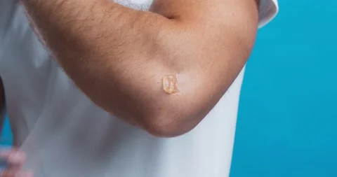 Man with elbow pain getting therapy massage with medicinal gel Stock Footage 137525006
