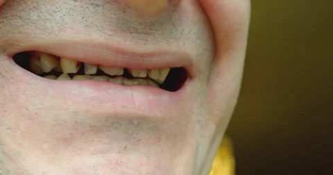 The man is embarrassed about his teeth. Stock Footage 327588022