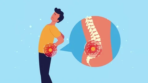 Man experiencing back pain shown with medical illustration of spine and inf.. Stock Footage 334538485