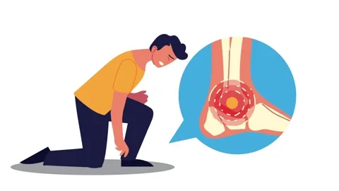 Man experiencing severe ankle pain with anatomical x-ray animation showing .. Stock Footage 334538842