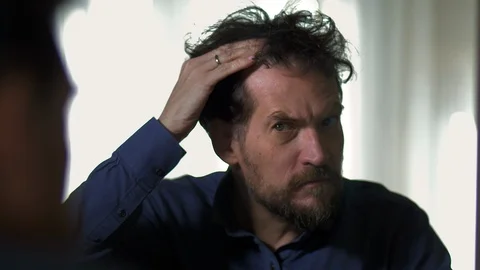 Man in front of mirror terrified about hair loss and hairline Stock Footage 126406650