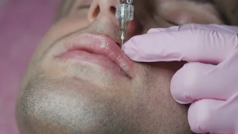 Man getting beauty injection for lips. Close-up of hands of cosmetologist making Stock Footage 156819860
