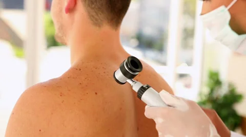 Man getting his mole checked by the dermatologist Видео 36030646