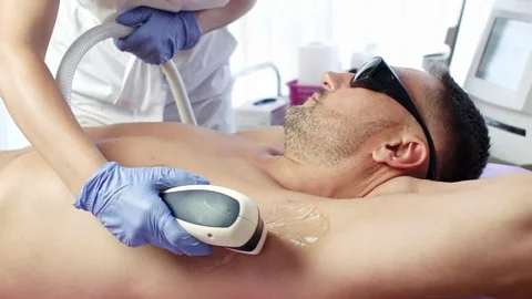 Man getting permanent laser armpit hair removal Stock Footage 78507490