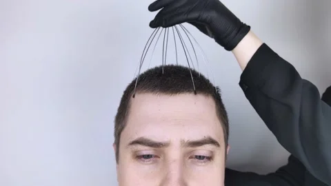 A man is given a head massage with a capillary massager in the salon. The client Stock Footage 147191078