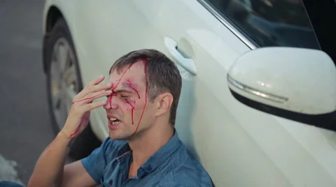 Man had a car accident. head smashed. pedestrian injured in road accidents Stock Footage 68444686