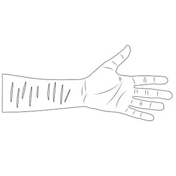 Man hand with scars on wrist after suicide attempt. isolated outline vector i Stock Illustration