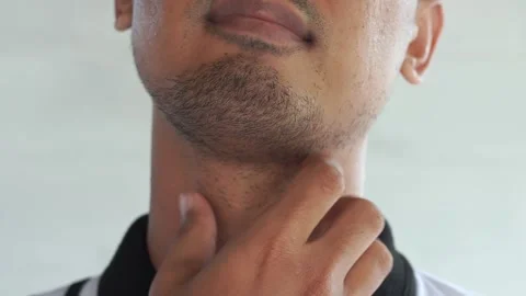 Man hand scratching on his neck, itchy skin Video stock 327649143