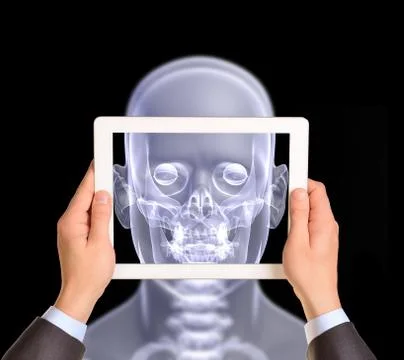 Man hands using tablet pc. Image of x-ray head on screen Stock Illustration