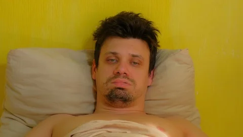 Man with hangover claps on cheeks to wake up lying in bed, portrait closeup. Stock Footage 128958307