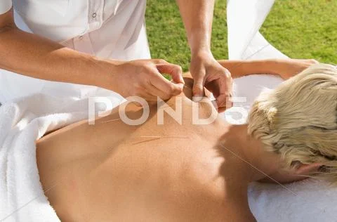 Man Having Acupuncture Outdoors