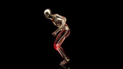 Man having painful joints while running, anatomy, runner knee injury, Jogging Video stock 165464344