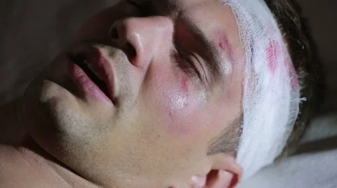 Man with head injuries lying on the bed. bandaged head. bruise on his face. Stock Footage 68323213