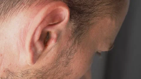 Man holding his aching ear, suffering from otitis, sudden hearing loss. Stock Footage 138577818