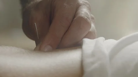 Man Inserting Needle Into Woman's Back Stock Footage 275051596