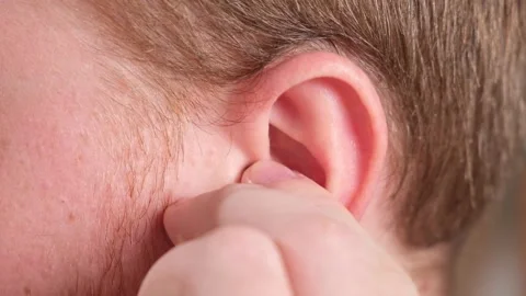 Man inserts earplugs so as not hear extraneous noise, music, snoring. Silicone Stock Footage 238501409