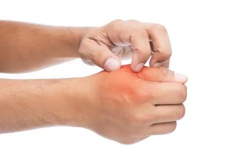 The man is itching hands Stock Photos