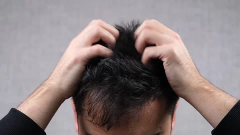 Man itching scratching head Stock Footage 260555056