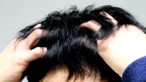 A man with an itchy head Stock Footage 336210840