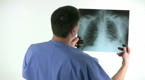 Man Looking Xrays Stock Footage 595085