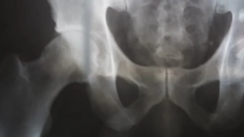 A man looks at the image from his hips x-ray against a window  at home  Stock Footage 169975964