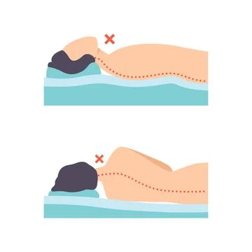 Man Lying in Incorrect Sleeping Pose for Neck and Spine Vector Set Stock Illustration