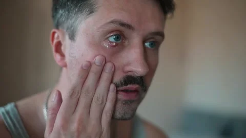 A man observes and studies the effects of chalazion on his eye and facial area. Stockbeeldmateriaal 337558538