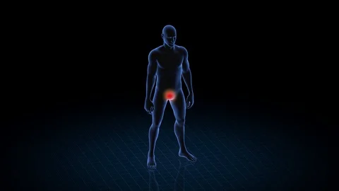 Man with pathology. 3d body of boy. Male human figure. Video stock 128656646