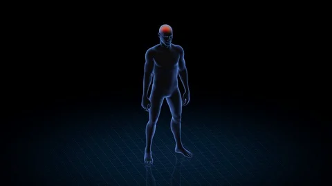 Man with pathology. 3d body of boy. Male human figure. Video stock 128657061