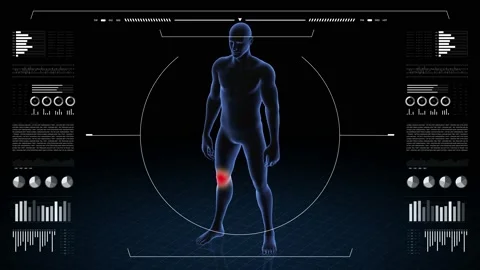 Man with pathology. 3d body of boy. Male human figure. Stock Footage 202072418