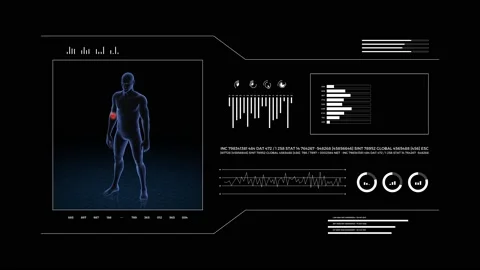 Man with pathology. 3d body of boy. Male human figure. Video stock 202072456
