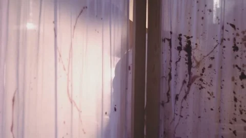 Man performs a surgical operation Stock Footage 76608027